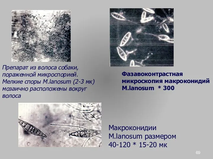 Препарат из волоса собаки, пораженной микроспорией. Мелкие споры M.lanosum (2-3 мк)