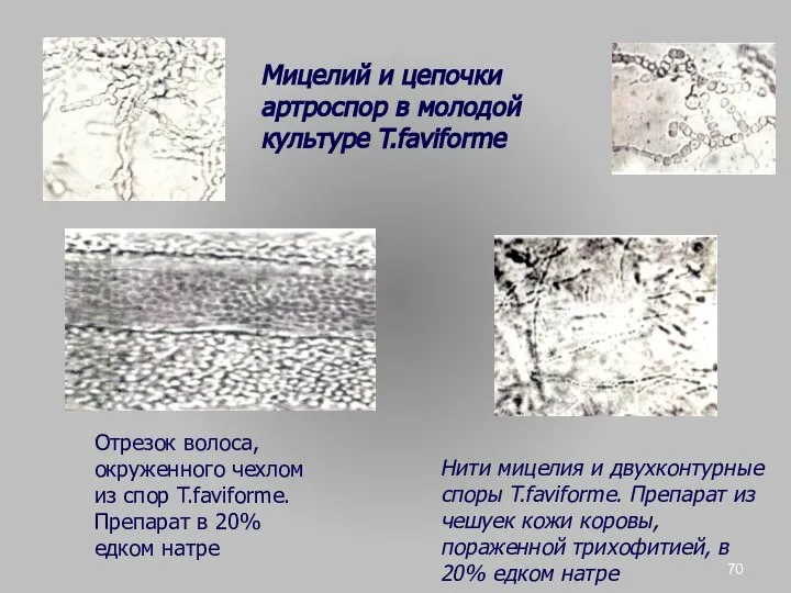 Мицелий и цепочки артроспор в молодой культуре T.faviforme Отрезок волоса, окруженного