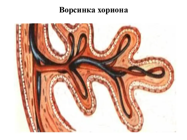 Ворсинка хориона