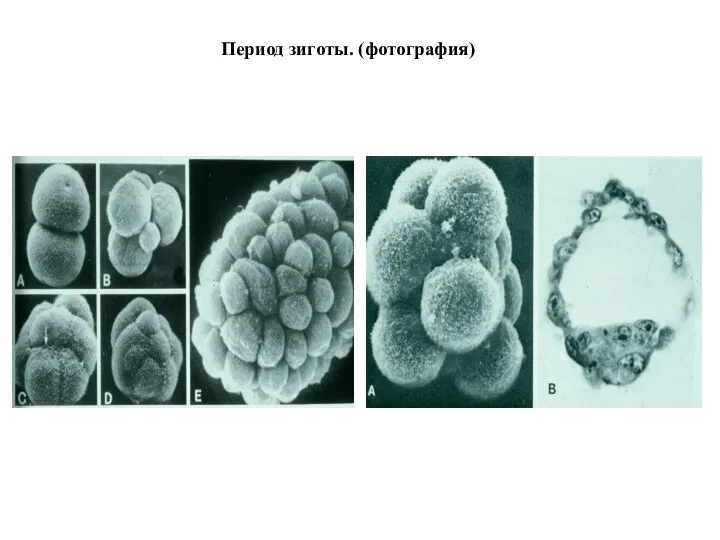 Период зиготы. (фотография)