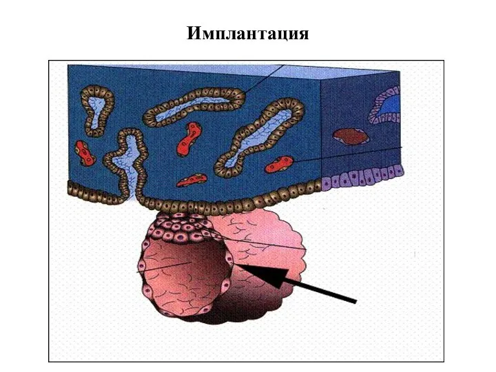 Имплантация