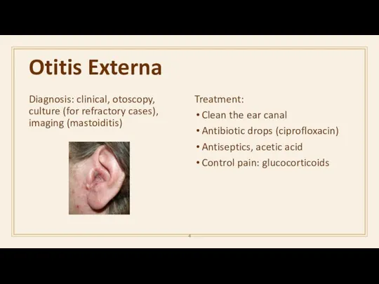 Otitis Externa Diagnosis: clinical, otoscopy, culture (for refractory cases), imaging (mastoiditis)