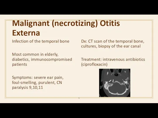 Malignant (necrotizing) Otitis Externa Infection of the temporal bone Most common