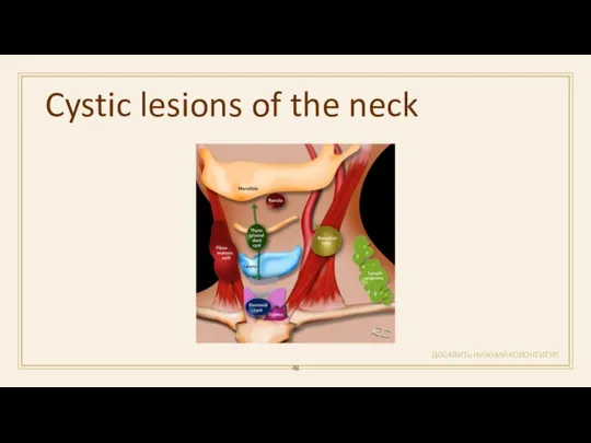 Cystic lesions of the neck ДОБАВИТЬ НИЖНИЙ КОЛОНТИТУЛ