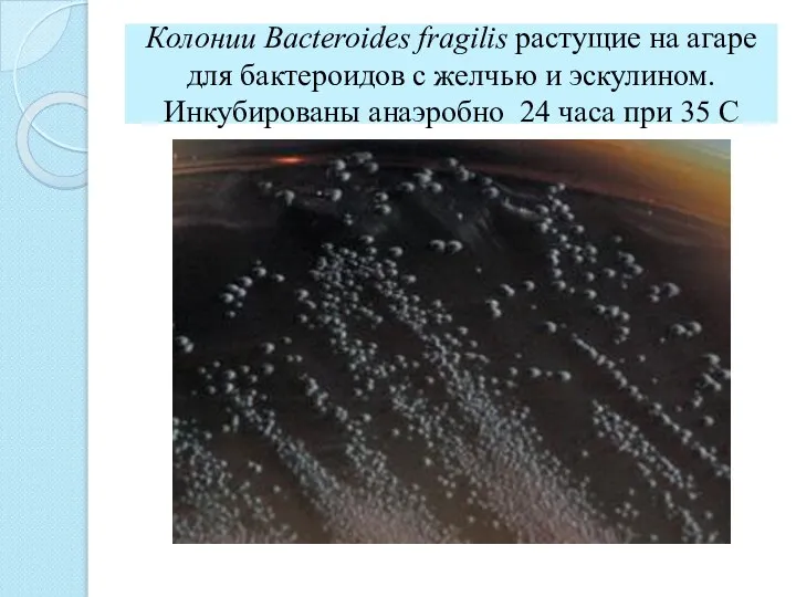 Колонии Bacteroides fragilis растущие на агаре для бактероидов с желчью и