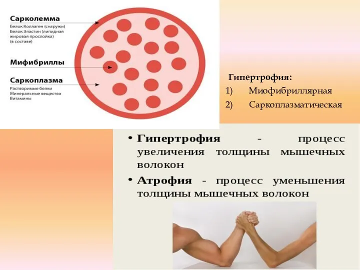 Гипертрофия: Миофибриллярная Саркоплазматическая