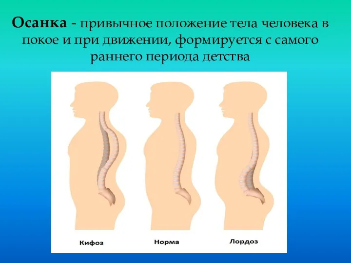 Осанка - привычное положение тела человека в покое и при движении,