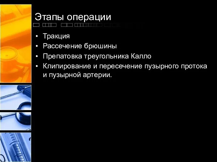 Этапы операции Тракция Рассечение брюшины Препатовка треугольника Калло Клипирование и пересечение пузырного протока и пузырной артерии.