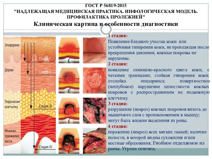 ГОСТ Р 56819-2015 "НАДЛЕЖАЩАЯ МЕДИЦИНСКАЯ ПРАКТИКА. ИНФОЛОГИЧЕСКАЯ МОДЕЛЬ. ПРОФИЛАКТИКА ПРОЛЕЖНЕЙ" Клиническая