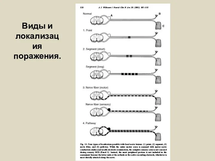 Виды и локализация поражения.