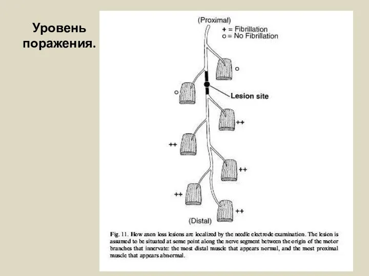 Уровень поражения.