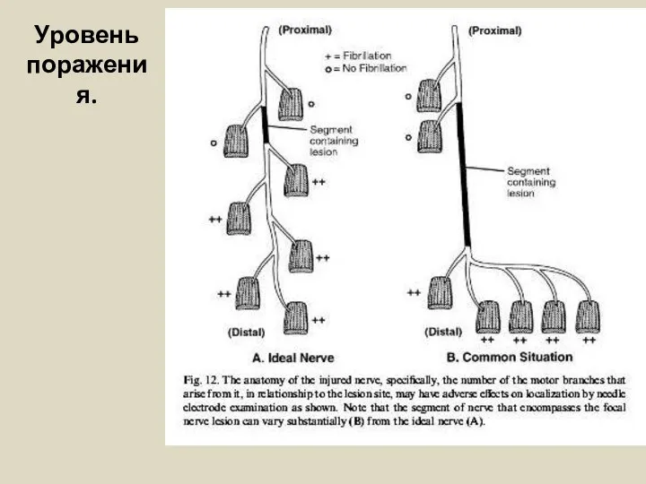 Уровень поражения.