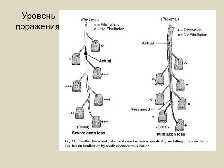 Уровень поражения.