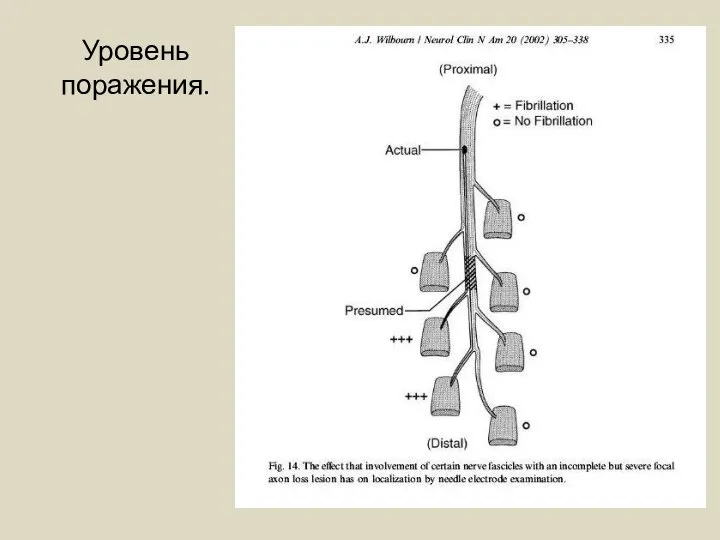 Уровень поражения.