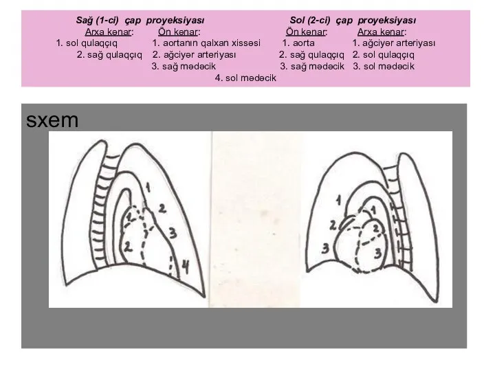 Sağ (1-ci) çap proyeksiyası Sol (2-ci) çap proyeksiyası Arxa kənar: Ön