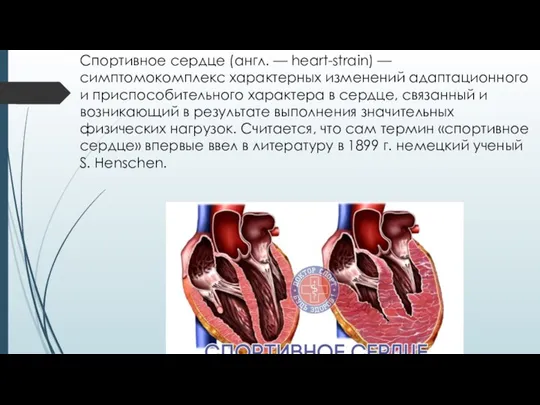 Спортивное сердце (англ. — heart-strain) — симптомокомплекс характерных изменений адаптационного и