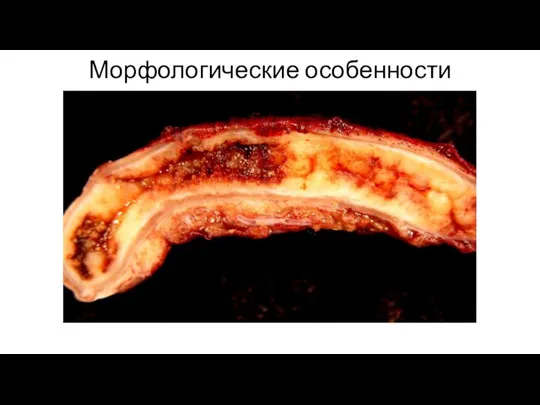 Морфологические особенности