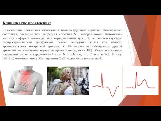 Классические проявления заболевания: боль за грудиной, одышка, синкопальные состояния, элевация или