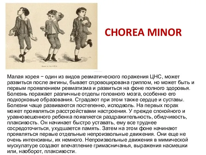 CHOREA MINOR Малая хорея − один из видов ревматического поражения ЦНС,