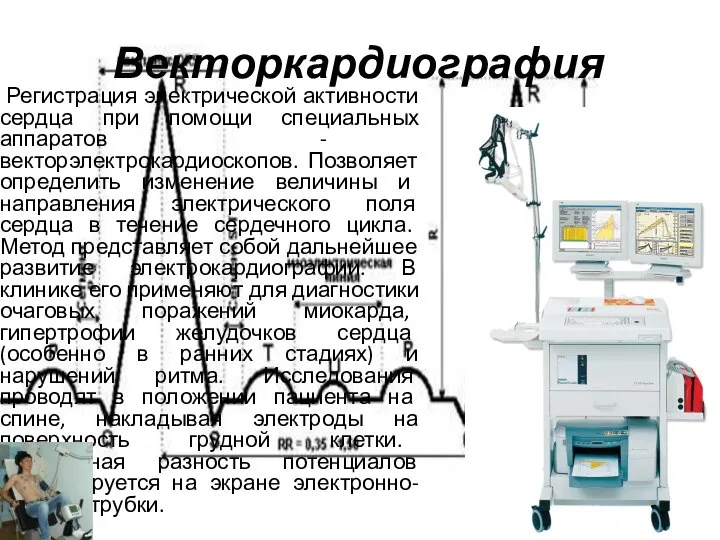 Векторкардиография Регистрация электрической активности сердца при помощи специальных аппаратов - векторэлектрокардиоскопов.