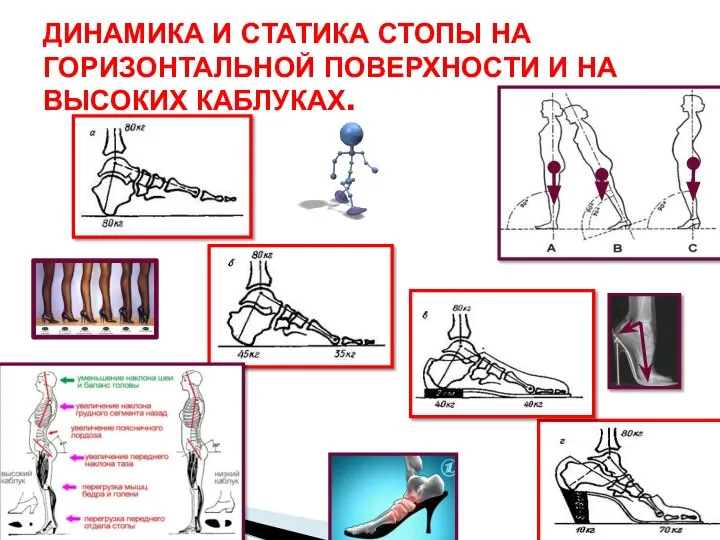 ДИНАМИКА И СТАТИКА СТОПЫ НА ГОРИЗОНТАЛЬНОЙ ПОВЕРХНОСТИ И НА ВЫСОКИХ КАБЛУКАХ.