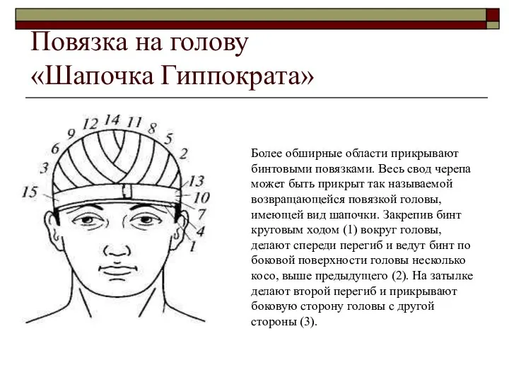 Повязка на голову «Шапочка Гиппократа» Повязка «чепец». Наиболее отвечающей современным требованиям