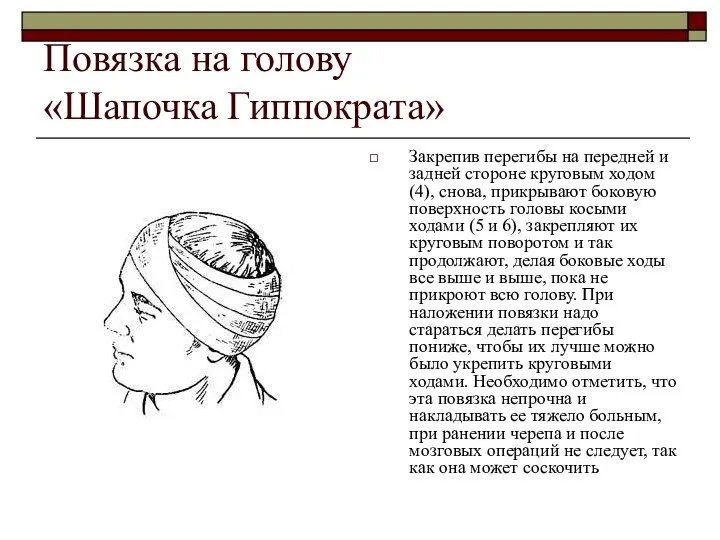 Повязка на голову «Шапочка Гиппократа» Закрепив перегибы на передней и задней