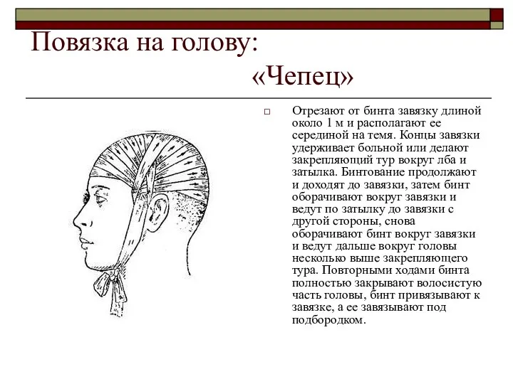 Повязка на голову: «Чепец» Отрезают от бинта завязку длиной около 1