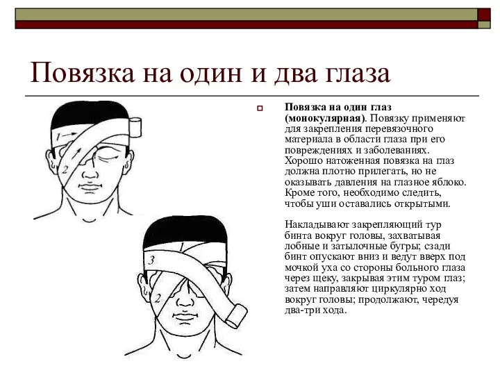 Повязка на один и два глаза Повязка на один глаз (монокулярная).