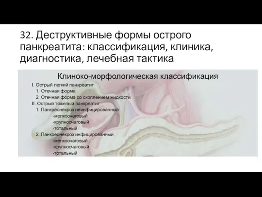 32. Деструктивные формы острого панкреатита: классификация, клиника, диагностика, лечебная тактика