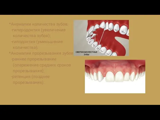 *Аномалии количества зубов: -гиперодонтия (увеличение количества зубов); -гиподонтия (уменьшение количества). *Aнoмалии