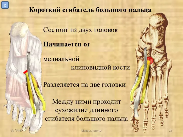 УрГУФК Мышцы стопы Короткий сгибатель большого пальца Состоит из двух головок