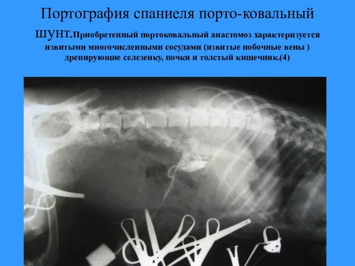 Портография спаниеля порто-ковальный шунт.Приобретенный портоковальный анастомоз характеризуется извитыми многочисленными сосудами (извитые