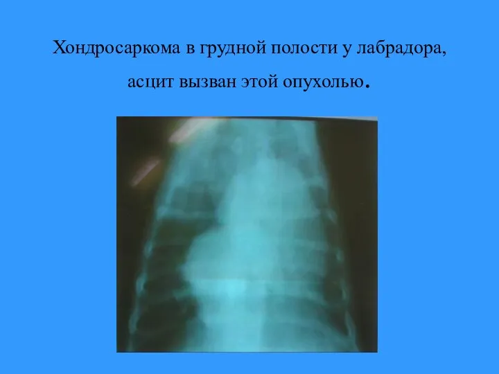 Хондросаркома в грудной полости у лабрадора, асцит вызван этой опухолью.