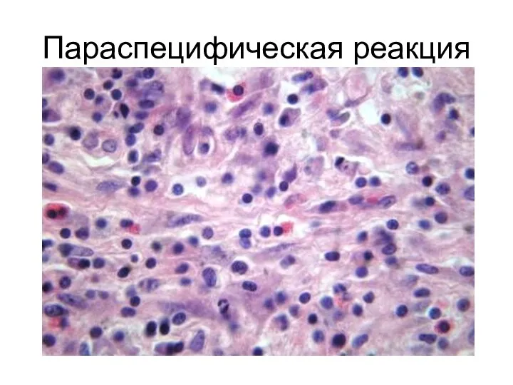 Параспецифическая реакция