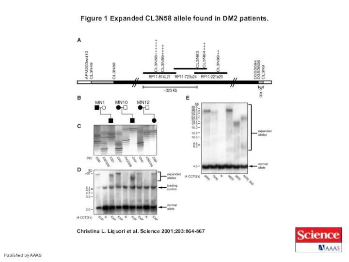 Figure 1 Expanded CL3N58 allele found in DM2 patients. Christina L.
