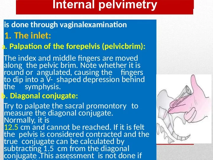 Internal pelvimetry is done through vaginalexamination 1. The inlet: Palpation of