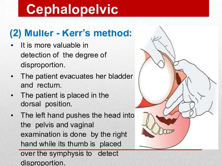 (2) Muller - Kerr’s method: It is more valuable in detection