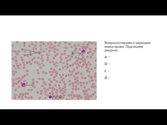 Микроскопируем и зарисуем мазок крови. Подпишем рисунок. a - b - c - d -