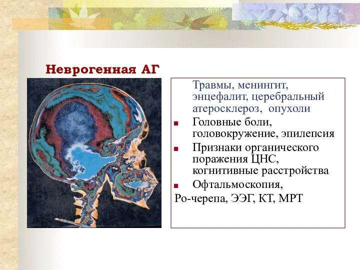 Неврогенная АГ Травмы, менингит, энцефалит, церебральный атеросклероз, опухоли Головные боли, головокружение,