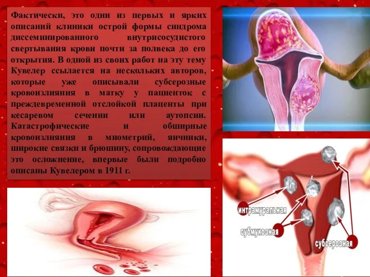 Фактически, это одни из первых и ярких описаний клиники острой формы