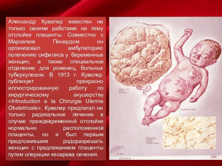 Александр Кувелер известен не только своими работами на тему отслойки плаценты.