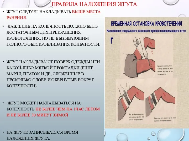 ПРАВИЛА НАЛОЖЕНИЯ ЖГУТА ЖГУТ СЛЕДУЕТ НАКЛАДЫВАТЬ ВЫШЕ МЕСТА РАНЕНИЯ. ДАВЛЕНИЕ НА