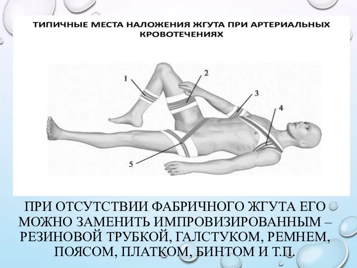 ПРИ ОТСУТСТВИИ ФАБРИЧНОГО ЖГУТА ЕГО МОЖНО ЗАМЕНИТЬ ИМПРОВИЗИРОВАННЫМ – РЕЗИНОВОЙ ТРУБКОЙ,