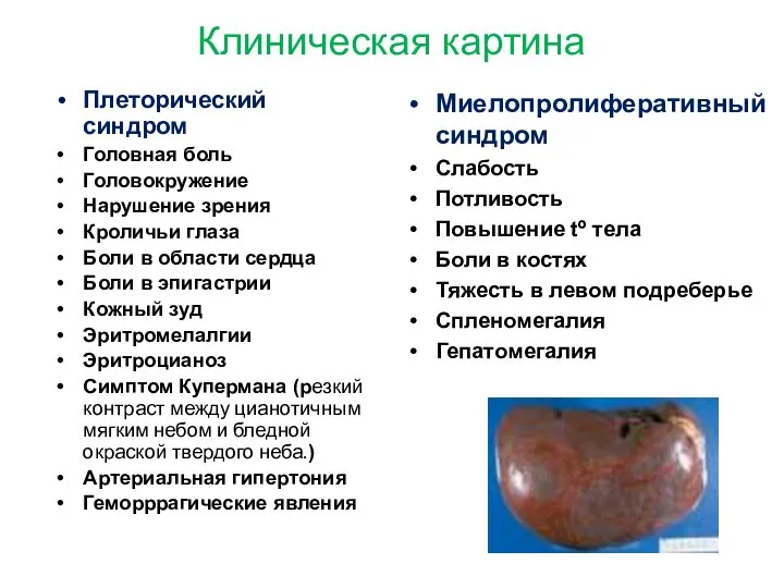 Клиническая картина Плеторический синдром Головная боль Головокружение Нарушение зрения Кроличьи глаза