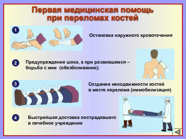 Первая медицинская помощь при переломах костей Создание неподвижности костей в месте