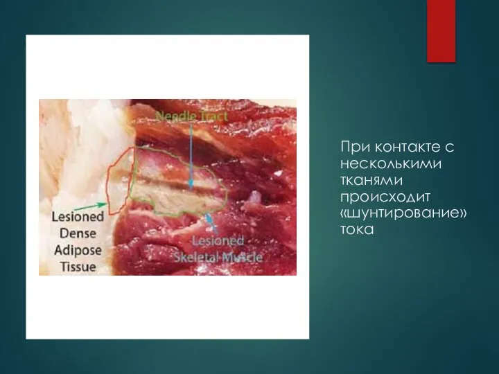 При контакте с несколькими тканями происходит «шунтирование» тока