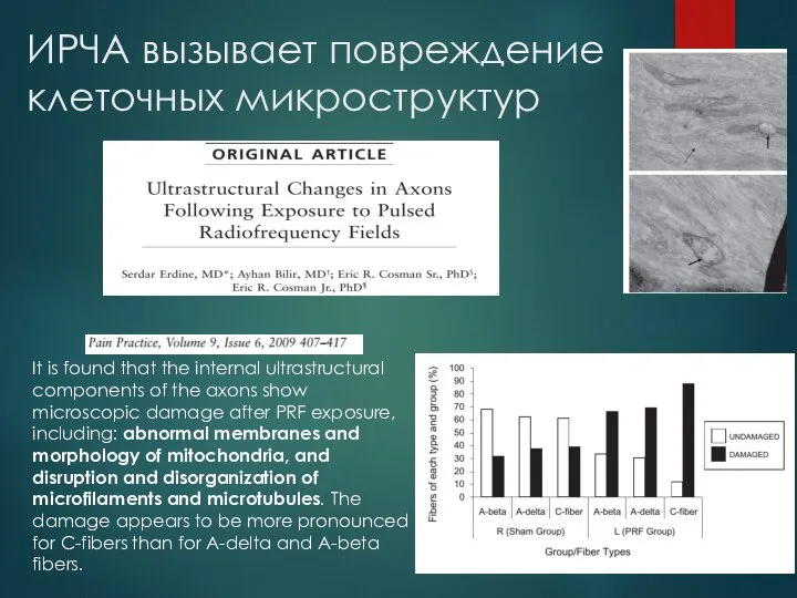 ИРЧА вызывает повреждение клеточных микроструктур It is found that the internal