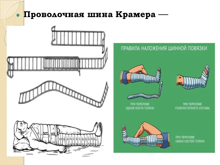 Проволочная шина Крамера —