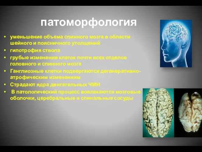 патоморфология уменьшение объема спинного мозга в области шейного и поясничного утолщений